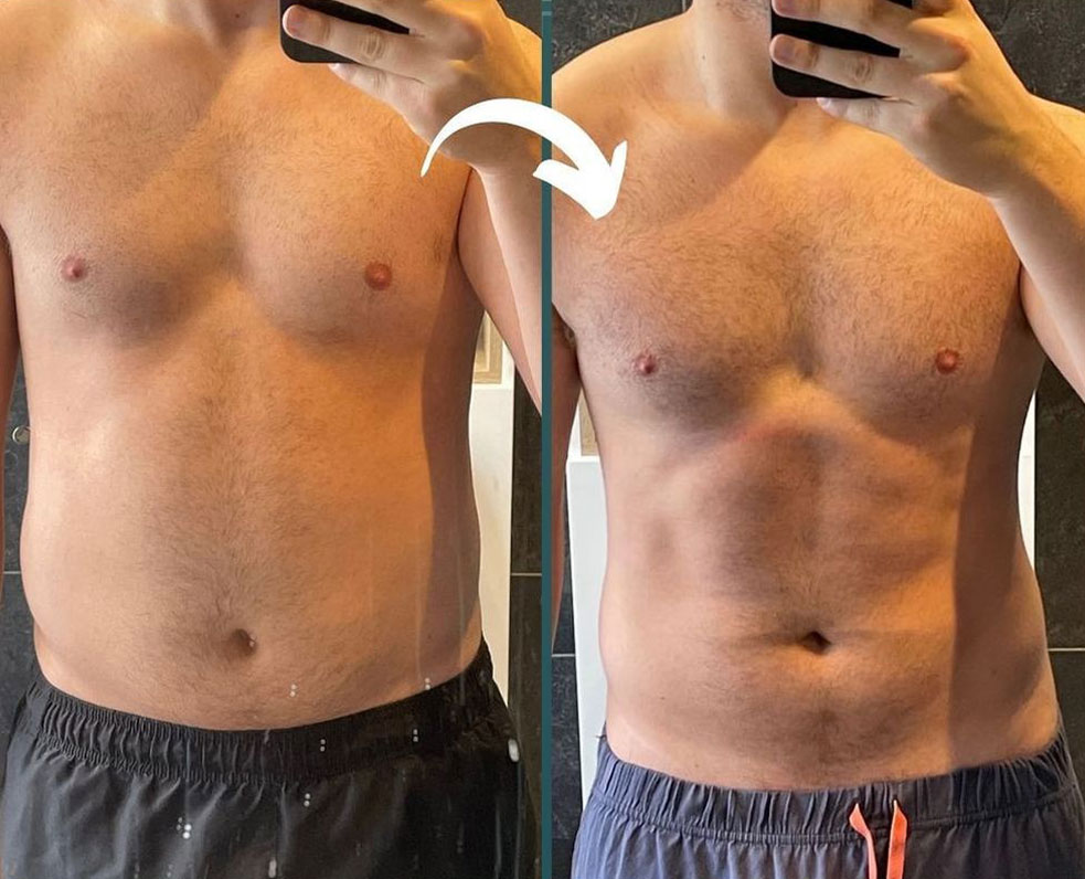 Before and after picture of a male client.